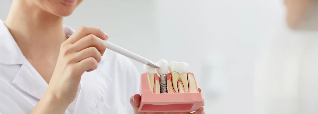 Dentista segurando dentadura